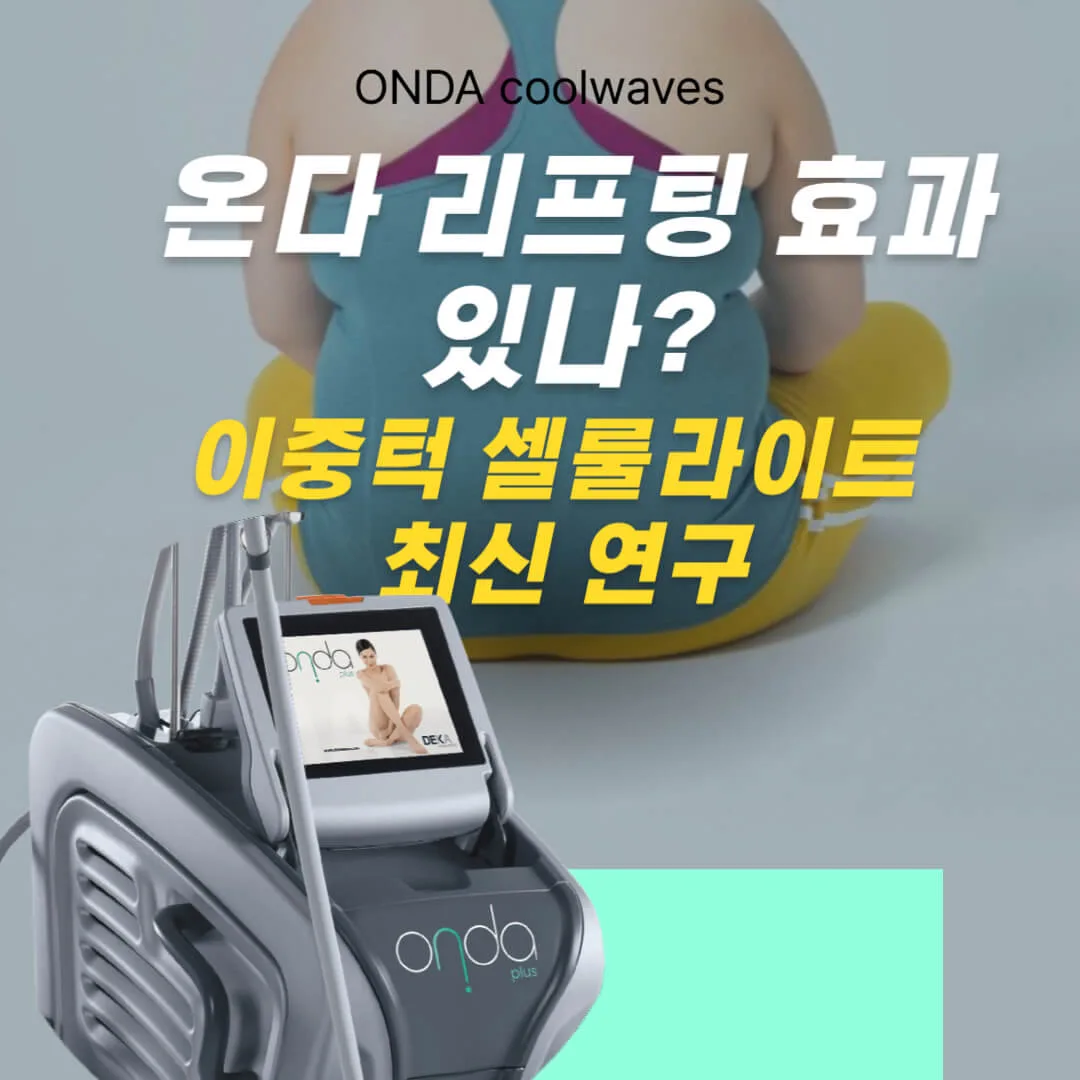 온다 리프팅 효과 있나? 이중턱, 셀룰라이트 최신 연구